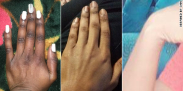 Kenya Battles Skin Bleaching Trend Despite Ban on 400 Dangerous Cosmetics