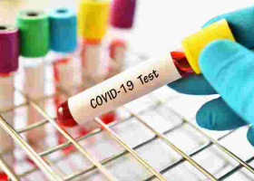 US-Based Kenyan Student Shows Coronavirus-Like Signs Shortly After Arriving in Kenya from the US, Isolated