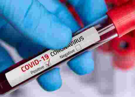 Eight More People Test Positive for Covid-19 in Kenya, Tally Rises to 216