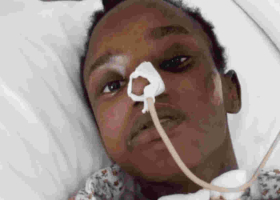 Kenyan Woman Fighting for Her Life After a Brutal Attack in Albania, Family Appeals for Help