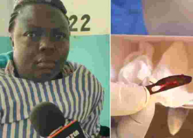 Doctors Remove a Scalpel Blade from Kenyan Woman’s Abdomen 11 Years After Surgery