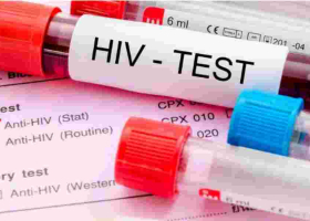 Concern as Nine Kenyan Counties Record Surge in HIV Cases