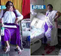Lung Patient Caught in Tussle Over Millions Kenyans Donated for Her Treatment in India