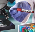 Coronavirus: Another Kenyan Student Who Returned from China Isolated After Showing Symptoms