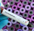 Nairobi Couple Allowed to Go Home Despite Testing Positive for Coronavirus 