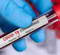 Eight More People Test Positive for Covid-19 in Kenya, Tally Rises to 216