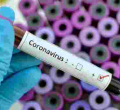 Six Kenyan MPs Hospitalized After Contracting Covid-19, One in ICU