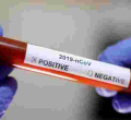Covid-19 Cases in Kenya Surpass 8,000 as Death Toll Hits 164