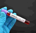 Gov’t Fears Hospitals May be Overwhelmed as Kenya Posts Highest Covid-19 Cases