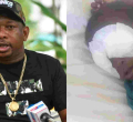 Sonko Offers to Fly Baby Sagini to South China for Eye Implants