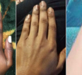 Kenya Battles Skin Bleaching Trend Despite Ban on 400 Dangerous Cosmetics
