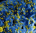 Ebola Concerns Rise as Kenya Confirms Nine Cases