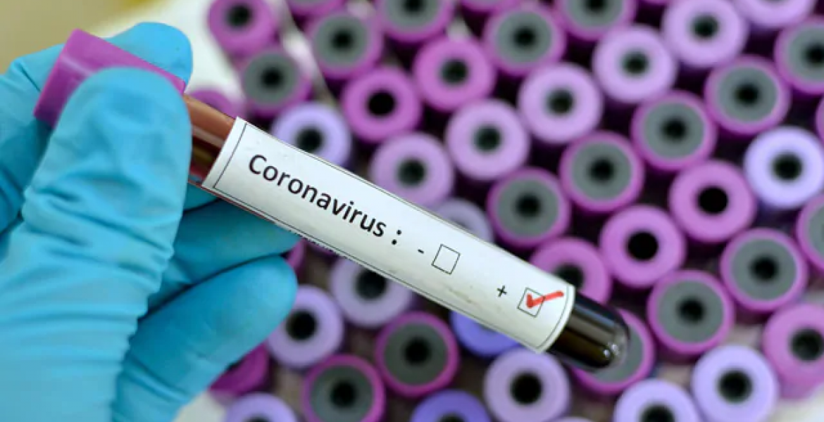Cameroon Records its First Coronavirus Case