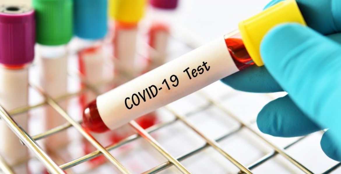 US-Based Kenyan Student Shows Coronavirus-Like Signs Shortly After Arriving in Kenya from the US, Isolated