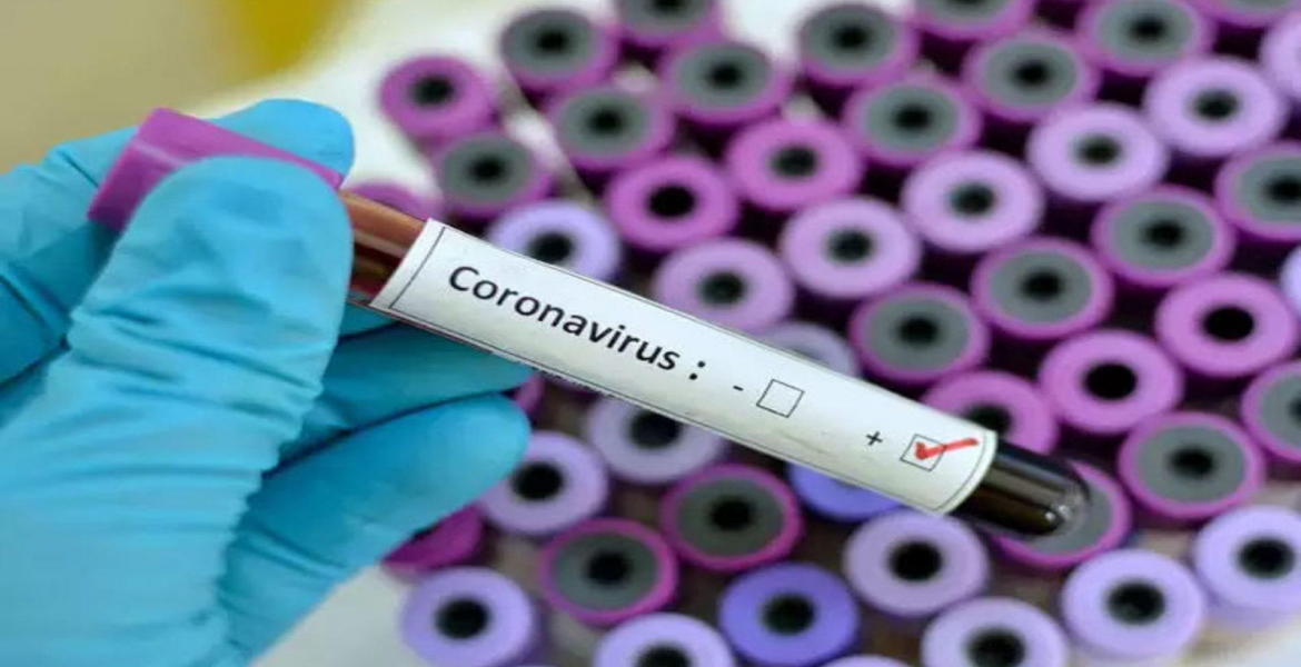 8-Month-Old Baby in Uganda Whose Dad Traveled from Kenya Tests Positive for Covid-19