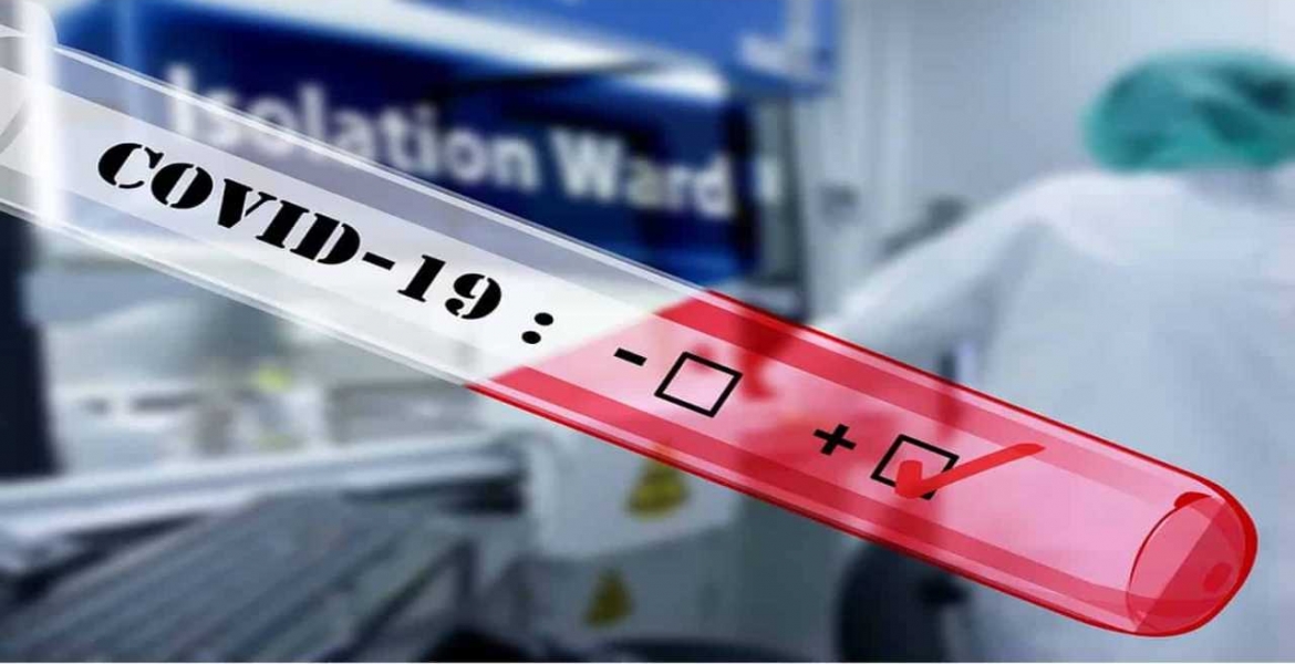 Kenya Posts Record Single-Day Covid-19 Positive Cases, Raising Tally to 887