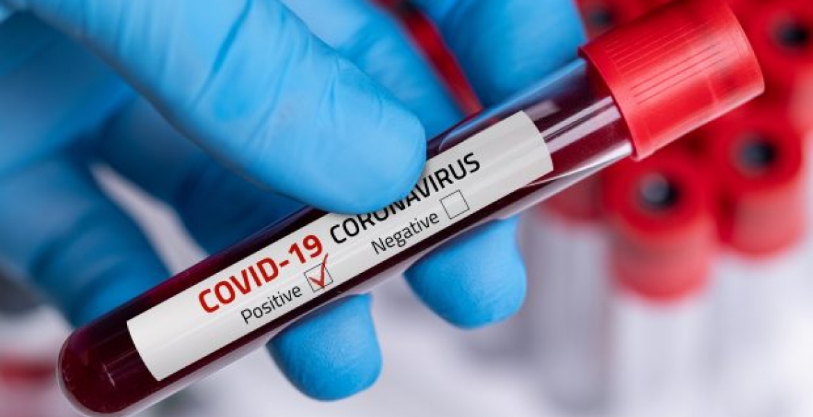 Covid-19 May be Transmitted Through Sex, Study Shows