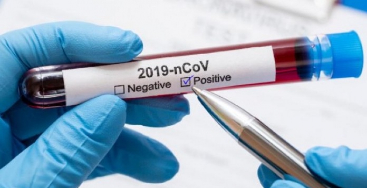 Kenya’s Covid-19 Infections Tally Passes the 2,000-Mark