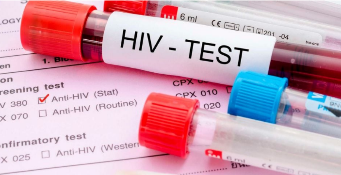 Out of the 17,680 new HIV Infections Among Adults in Kenya, 41pc are Aged Between 25 and 34 Concern as Nine Kenyan Counties Record Surge in HIV Cases