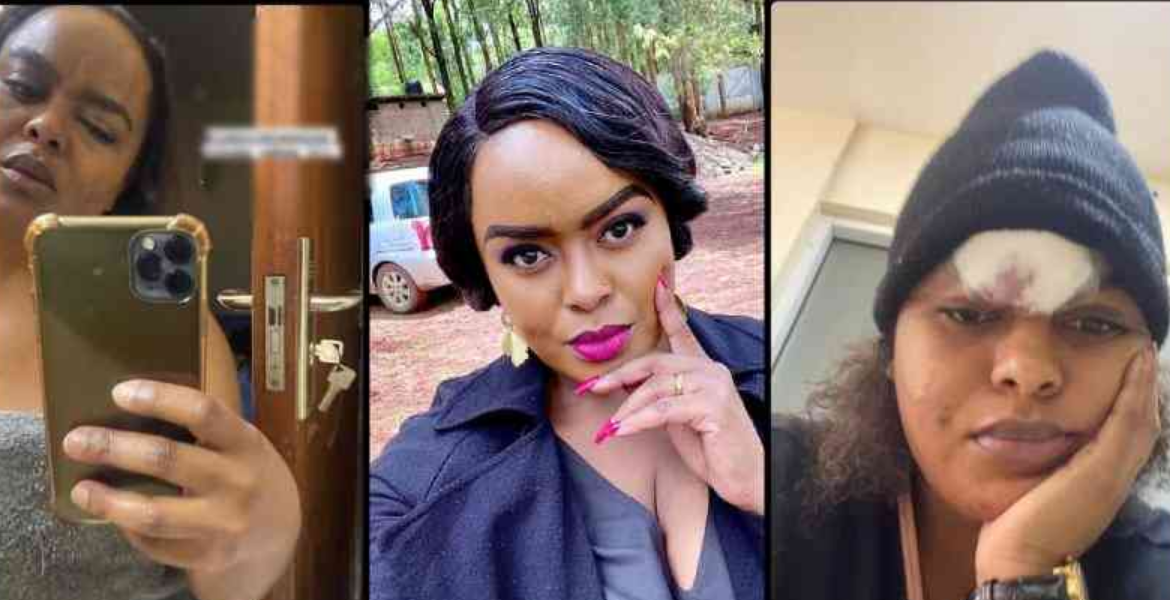 Avril Nyambura Singer Avril's Bruised Selfies Go Viral, Prompting Anger and Calls for Accountability