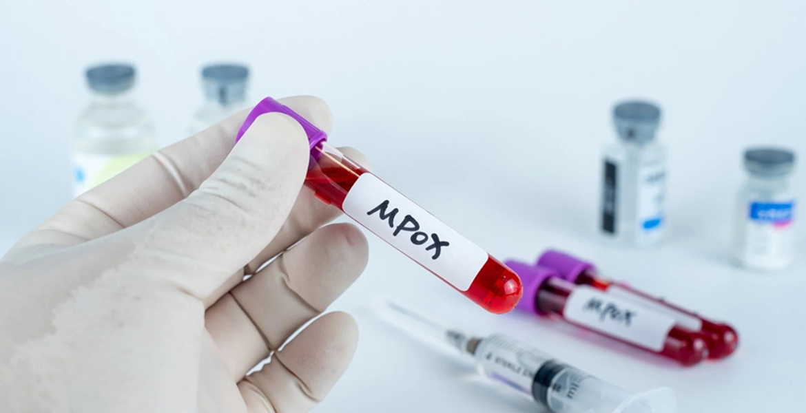 Mpox Kenya Intensifies Mpox Surveillance Amid Rising Cases