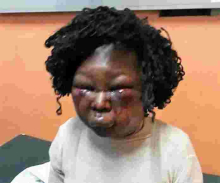 Kenyan Man Who Battered Expectant Wife Almost to Death Arrested