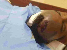 Senator Anwar Loitiptip Admitted to ICU After Attack by Armed Men at a Nairobi Club
