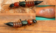 Kenyans Decry the Return of the Dreaded ‘Nairobi Fly’