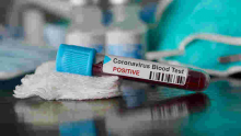 Ugandan Man, Daughter Arrested with Alleged Coronavirus ‘Vaccine’