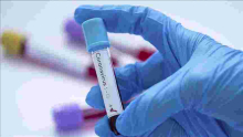 Kenyan Scientists to Conduct Trial for Three Possible Covid-19 Drugs 