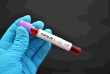 Gov’t Fears Hospitals May be Overwhelmed as Kenya Posts Highest Covid-19 Cases