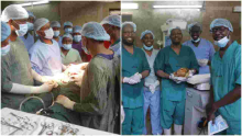History as Kenyan Doctors Successfully Remove 13-Year-Old Stone Baby from Woman’s Abdomen 