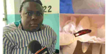 Doctors Remove a Scalpel Blade from Kenyan Woman’s Abdomen 11 Years After Surgery