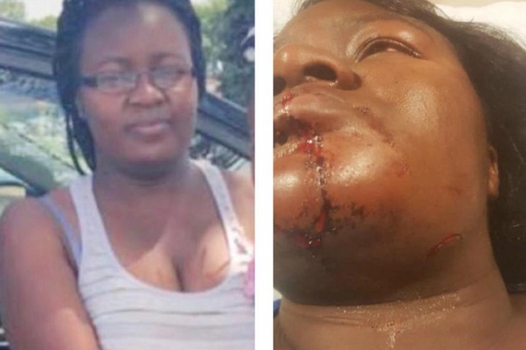 Kenyan Woman in Minnesota Nursing Serious Injuries after Attack by Husband at a Petrol Station