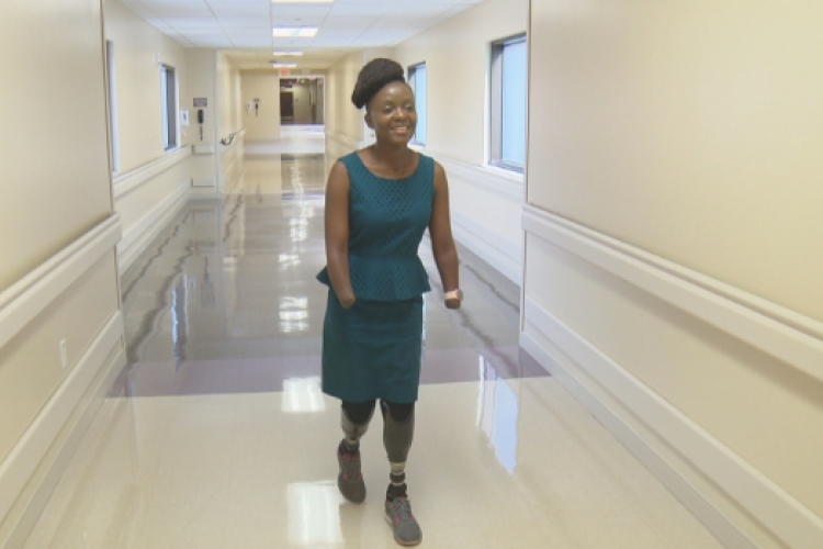 How Victoria Mugo, a Kenyan Woman in the US, Lost All Her Hands and Legs 